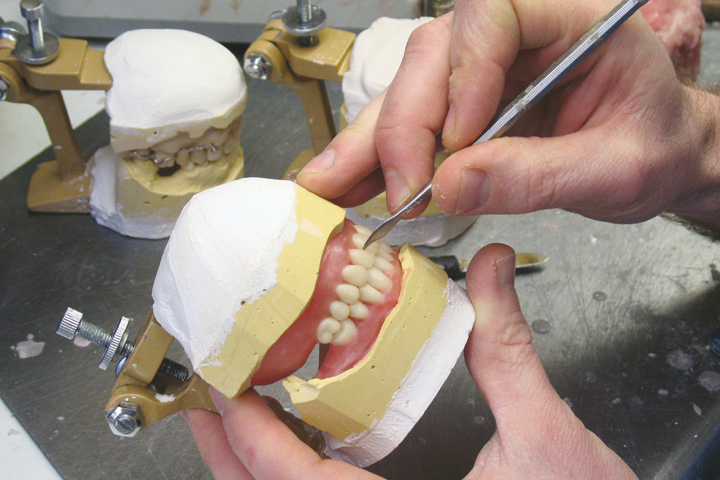 Denture Repairs